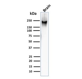 Western blot testing of human brain lysate with Neurofilament Heavy antibody (clone RT97).