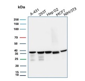 Western blot testing of human A431, 293T, HepG2 and MCF7 cell lysate and mouse NIH 3T3 cell lysate with PCNA antibody. Predicted molecular weight ~29 kDa, routinely observed at 29~36 kDa.