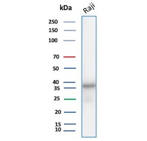 Western blot testing of human Raji cell lysate with PCNA antibody. Predicted molecular weight ~29 kDa, routinely observed at 29~36 kDa.