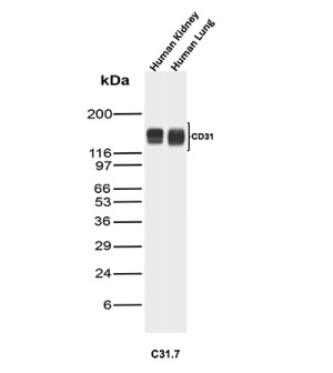 PECAM-1 Antibody Human Tissue WB. Western blot testing of human kidney and human lung tissue lysates with PECAM-1 Antibody (clone C31.7). A specific band was detected at approximately 130-140 kDa, consistent with the expected molecular weight range of PECAM-1/CD31. PECAM-1 Antibody, clone C31.7, supports detection of platelet endothelial cell adhesion molecule 1 expression and studies of endothelial cells, vascular biology, angiogenesis and cell adhesion pathways.