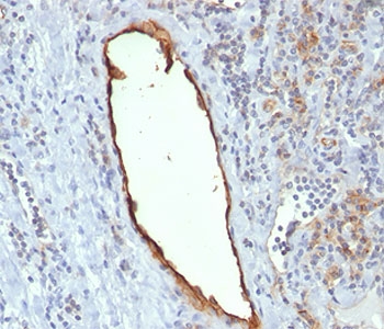 PECAM-1 antibody C31.7 immunohistochemistry tonsil (clone C31.7).