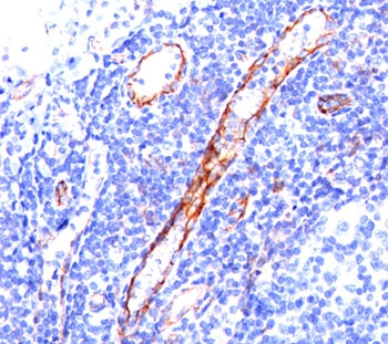 CD31 antibody C31.3 immunohistochemistry tonsil