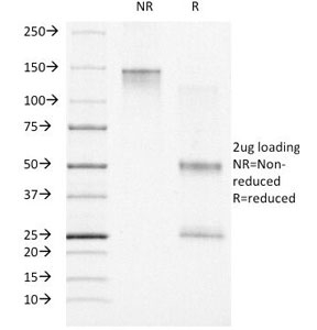 SDS-PAGE Analysis of Purified, BSA-Free Progesterone Receptor Antibody Clone PR500. Confirmation of Integrity and Purity of the Antibody.