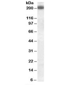 Western blot testing of Daudi cell lysate with CD45RB antibody (clone PD7/26). Predicted molecular weight: ~147/180~220kDa (unmodified/glycosylated).