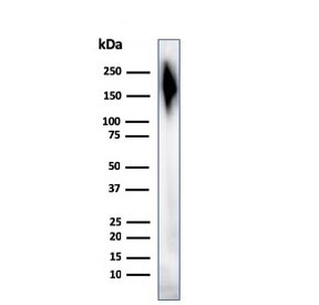 Western blot testing of human spleen tissue lysate with CD45 antibody cocktail.