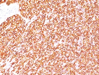 IHC staining of FFPE human tonsil tissue with CD45RB antibody (clone BRA-11). HIER: boil tissue sections in pH 9 10mM Tris with 1mM EDTA for 20 min and allow to cool before testing.