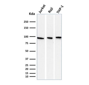 Western blot testing of human 1) Jurkat, 2) Raji and 3) ThP-1 cell lysate with Transferrin receptor antibody (clone DF1513). Predicted molecular weight: 85-95 kDa.