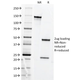 SDS-PAGE analysis of purified, BSA-free Transferrin receptor antibody (clone DF1513) as confirmation of integrity and purity.