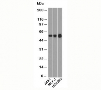 p53 Antibody Clone BP53-12 / TP53 Tumor Suppressor Antibody. Western blot analysis of human cell lysates demonstrates detection of Tumor protein p53 across multiple cell lines using p53 Antibody Clone BP53-12. Lane 1: A431 cell lysate, Lane 2: MCF-7 cell lysate, Lane 3: HEK293 cell lysate. A band is detected at approximately 53 kDa, consistent with the predicted molecular weight of p53 / TP53.