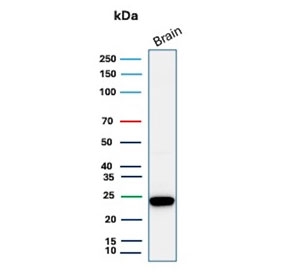 Western blot testing of human brain lysate with PGP9.5 antibody (clone 31A3). Predicted molecular weight ~25 kDa.