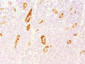 IHC testing of FFPE human pancreas tissue with vWF antibody (clone 3E2D10). Staining of formalin-fixed tissues requires boiling tissue sections in pH 9 10mM Tris with 1mM EDTA for 10-20 min followed by cooling at RT for 20 minutes.