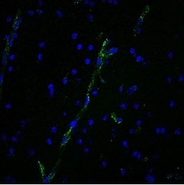 vWF Antibody for IF / von Willebrand Factor Immunofluorescence Antibody immunofluorescence analysis. Immunofluorescent staining of human brain tissue using vWF Antibody for IF (clone 3E2D10) shows strong endothelial-specific signal (green) highlighting vascular structures, with nuclei counterstained using DAPI (blue). The staining pattern reveals linear and tubular vessel-associated fluorescence consistent with endothelial cell localization of von Willebrand factor (VWF), enabling clear visualization of microvascular architecture within brain tissue.
