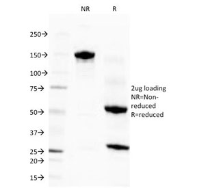 Eosinophil Peroxidase Antibody Clone EPO14 SDS-PAGE Analysis. SDS-PAGE characterization of purified, BSA-free Eosinophil peroxidase / EPX antibody (clone EPO14) under non-reducing (NR) and reducing (R) conditions. A predominant band is observed at approximately 150 kDa under non-reducing conditions, consistent with intact IgG, while reducing conditions reveal bands at approximately 50 kDa and 25 kDa corresponding to heavy and light chains, respectively. The clean banding pattern confirms antibody integrity and purity with minimal degradation or contaminating proteins.