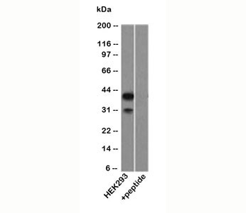 p40 Antibody. Western blot analysis of HEK293 cell lysate demonstrates detection of Tumor protein p40 (deltaNp63) as a prominent band near ~40 kDa, with an additional lower band observed at ~30-35 kDa. The ~40 kDa signal is consistent with shorter deltaNp63 isoforms reported in the literature, including deltaNp63gamma, which migrates below the full-length protein. The lower band may represent further truncated or proteolytically processed deltaNp63-related species that retain the antibody epitope. The presence of these bands reflects the known complexity of TP63 isoform expression and processing.