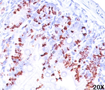 BrdU antibody BRD469 immunohistochemistry intestine 20X