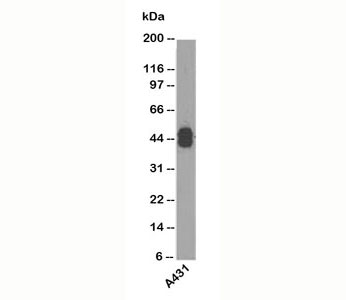 Acidic Cytokeratin antibody AE1 western blot