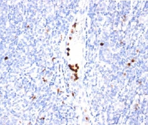 Myeloid Differentiation Marker Antibody Tonsil IHC. Immunohistochemistry analysis of human tonsil tissue stained with Myeloid Differentiation Marker Antibody clone BM-2 demonstrates distinct cytoplasmic HRP-DAB brown staining within scattered myeloid lineage-associated immune cell populations distributed throughout lymphoid tissue compartments. This BM-2 antibody highlights granulocytic differentiation-associated cellular expression patterns consistent with innate immune signaling and inflammatory tissue organization.
