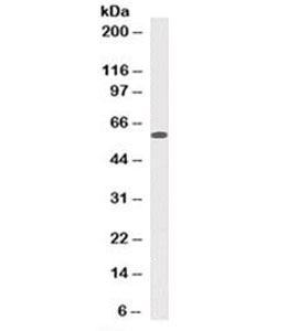 Western blot testing of human HeLa cell lysate with Mitochondrial Marker antibody (clone 113-1).