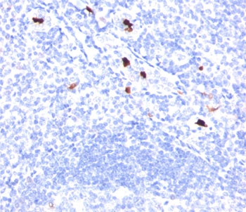 Macrophage / Granulocyte Marker Antibody Tonsil IHC. Immunohistochemistry analysis of formalin-fixed, paraffin-embedded human tonsil tissue stained with Macrophage / Granulocyte Marker Antibody clone BM-1 demonstrates distinct HRP-DAB brown staining within scattered myeloid lineage-associated immune cell populations distributed throughout lymphoid tissue compartments. This BM-1 antibody highlights macrophage and granulocyte-associated cellular infiltration patterns consistent with innate immune-associated signaling and inflammatory tissue organization.