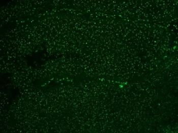 Immunofluorescent staining of FFPE colon carcinoma with Alexa Fluor 488 conjugated Nucleoli Marker antibody. HIER: boil tissue sections in pH6, 10mM citrate buffer, for 10-20 min and allow to cool before testing.