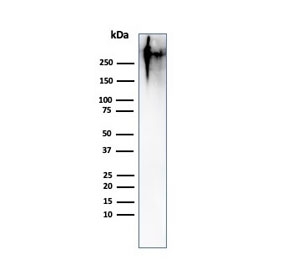 Western blot testing of human MCF7 cell lysate with Epithelial Marker Antigen antibody (clone MUC1/967). This glycoprotein is commonly visualized between 120~500 kDa.