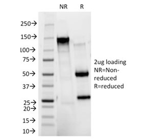 SDS-PAGE analysis of purified, BSA-free HER2 antibody as confirmation of integrity and purity.