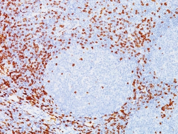 IHC testing of FFPE tonsil tissue with highly published CD8 antibody clone C8/144B.