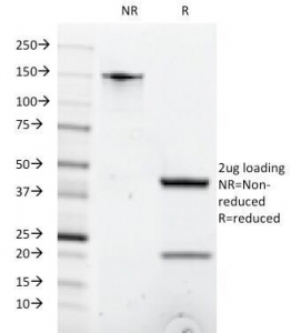 CD8A Antibody SDS-PAGE. SDS-PAGE Analysis of Purified, BSA-Free CD8A Antibody for FACS - Human Lymphocyte Gating Antibody (clone C8/1035). Confirmation of Integrity and Purity of the Antibody.