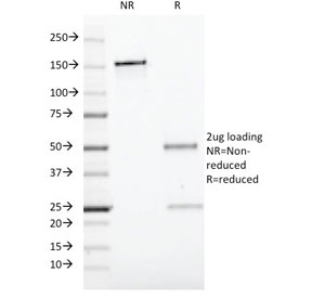 SDS-PAGE analysis of purified, BSA-free CD19 antibody (clone CVID3/429) as confirmation of integrity and purity.