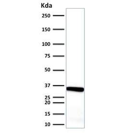 Calponin Antibody Endometrium Tissue WB. Western blot testing of human endometrium tissue lysate with Calponin antibody. Predicted molecular weight ~34 kDa.