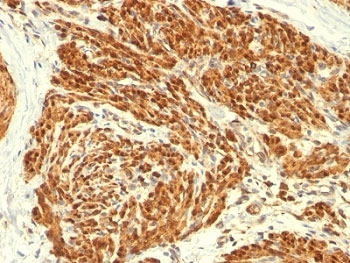 IHC: Formalin-fixed, paraffin-embedded human uterus stained with Calponin antibody (CALP).