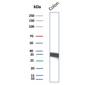 Calponin Antibody Immunoblot. Western blot testing of human colon tissue lysate with Calponin antibody. Predicted molecular weight ~34 kDa.