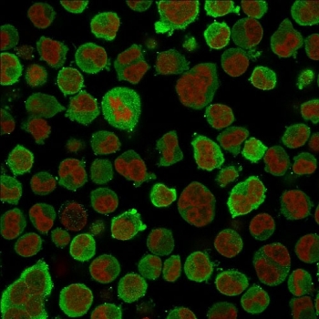 Calponin 1 Antibody K562 IF. Immunofluorescence analysis of PFA-fixed human K562 cells using Calponin 1 antibody (green). The mouse monoclonal antibody clone CNN1/832 shows cytoplasmic staining consistent with Calponin 1 / CNN1 localization, while nuclei are counterstained with Reddot (red). The signal highlights intracellular distribution of this actin-associated protein, supporting its role in cytoskeletal organization.