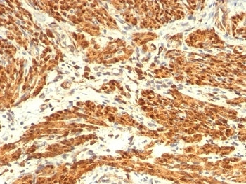 Calponin Antibody Cocktail Human Uterus IHC: Formalin-fixed, paraffin-embedded human uterus immunohistochemistry staining with Calponin Antibody Cocktail (clone CNN1/832 + CALP).