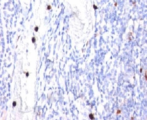 G-CSF Antibody Tonsil Immunohistochemistry. IHC: Formalin-fixed, paraffin-embedded human tonsil stained with G-CSF antibody (CSF3/900). Note specific cytoplasmic staining of granulocytes.