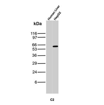 AFP Antibody Human Liver and HepG2 WB. Western blot analysis of human liver and HepG2 cell lysates using Alpha Fetoprotein Antibody (clone C2) detects a band at approximately 65-70 kDa in HepG2 cells, consistent with the expected molecular weight of Alpha fetoprotein. No band is observed in adult human liver lysate, reflecting the known suppression of AFP expression in normal adult liver and its re-expression in hepatocellular carcinoma-derived cells.