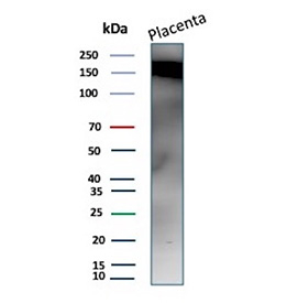 Fibronectin Antibody Placenta WB. Western blot analysis of human placenta tissue lysate using Fibronectin Antibody clone 568. A detectable high molecular weight band is observed near the expected molecular weight range of Fibronectin 1 / FN1, consistent with abundant placental expression of this extracellular matrix glycoprotein. Clone 568 recognizes the 8th Type III Repeat region of fibronectin, and the broad upper molecular weight signal is characteristic of glycosylated and dimeric FN1 species associated with extracellular matrix organization and tissue remodeling pathways.