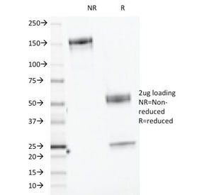 SDS-PAGE Analysis of Purified, BSA-Free CELA3B Antibody (clone CELA3B/1218). Confirmation of Integrity and Purity of the Antibody.
