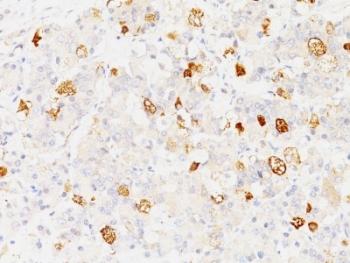FSHB Antibody Endocrine Cell Marker IHC. Immunohistochemical analysis of FFPE human pituitary using monoclonal clone SPM107 reveals punctate cytoplasmic HRP-DAB brown staining localized to dispersed endocrine cells within the adenohypophysis. The staining pattern is characteristic of secretory gonadotroph cells expressing Follicle stimulating hormone beta / FSHB.