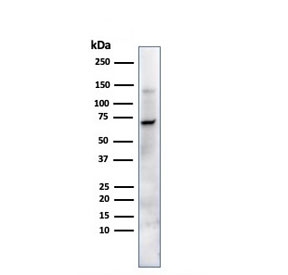 Placental Alkaline Phosphatase Antibody for WB. Western blot testing of human JEG-3 cell lysate with Placental Alkaline Phosphatase antibody. A band is detected at approximately 60-70 kDa, which is slightly higher than the predicted molecular weight of 58 kDa for Placental alkaline phosphatase / ALPP. The upward shift is consistent with glycosylation of this GPI-anchored membrane enzyme, which commonly alters apparent migration on SDS-PAGE.