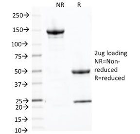 SDS-PAGE analysis of purified, BSA-free Placental Alkaline Phosphatase antibody (clone ALP/870) as confirmation of integrity and purity.