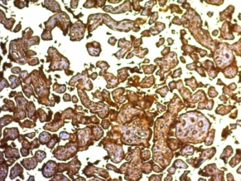 PLAP Antibody Clone SPM593 Placenta IHCImmunohistochemistry of PLAP Antibody Clone SPM593 in human placenta. Formalin-fixed, paraffin-embedded human placental tissue demonstrates strong HRP-DAB brown membranous staining in syncytiotrophoblastic cells lining chorionic villi, consistent with surface localization of placental alkaline phosphatase. Stromal and intervillous cells show minimal staining.