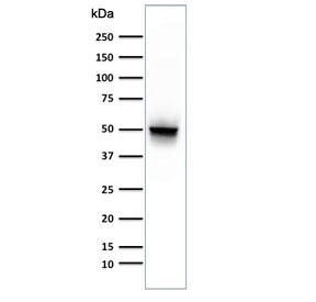 Western blot testing of human brain lysate with GFAP antibody (clone ASTRO/789). Predicted molecular weight ~50 kDa.