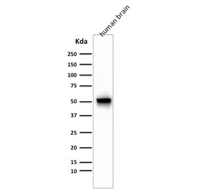 Western blot testing of human brain lysate with GFAP antibody cocktail (clones GA-5 + ASTRO/789). Predicted molecular weight ~50 kDa.