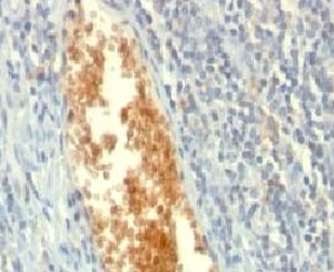 IHC: Formalin-fixed, paraffin-embedded human tonsil stained with AMPD3 antibody (clone AMPD3/901).
