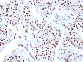 IHC: FFPE human testicular carcinoma tested with Histone H1 antibody (clone AE-4).