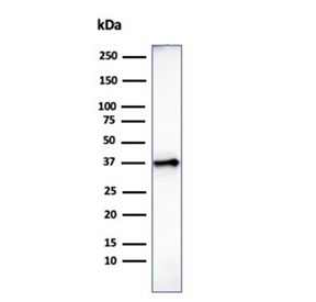 Histone H1 Antibody for WB. Western blot analysis of total histone H1 expression in human heart tissue lysate. A band is detected at approximately 22-33 kDa, consistent with the predicted molecular weight range of Histone H1 family proteins, with lower bands corresponding to unmodified forms and higher bands reflecting post-translationally modified variants. The observed band pattern aligns with the known heterogeneity of linker histone H1 isoforms and their modification-dependent mobility in chromatin-associated proteins.