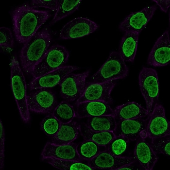 Histone H1 Antibody for IF. Immunofluorescence analysis of chromatin condensation-associated histone H1 expression in permeabilized human HeLa cells using Histone H1 Antibody (green). Strong nuclear staining is observed, consistent with localization of linker histone H1 within condensed chromatin regions and its role in higher-order chromatin organization. Clone SPM256 antibody demonstrates nuclear enrichment with minimal cytoplasmic signal. Actin filaments are labeled with phalloidin (red), providing cytoskeletal contrast to the chromatin-associated histone signal.