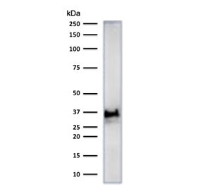 Histone H1 Antibody for WB. Western blot analysis of chromatin condensation-associated histone H1 expression in human heart tissue lysate. A band is detected at approximately 30-35 kDa, consistent with the predicted molecular weight range of Histone H1 family proteins and reflecting post-translationally modified forms associated with chromatin compaction. The observed band pattern aligns with the role of histone H1 in higher-order chromatin organization and condensed chromatin states.