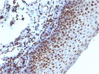 Histone H1 Antibody for IHC. Immunohistochemistry analysis of nucleosome spacing-associated histone H1 expression in FFPE human tonsil tissue using Histone H1 Antibody. Nuclear HRP-DAB brown staining is observed in lymphoid cells, consistent with localization of linker histone H1 within chromatin and its role in nucleosome spacing and linker DNA organization. Clone 1415-1 antibody demonstrates strong nuclear compartmentalization with minimal cytoplasmic staining, reflecting chromatin-associated distribution of histone H1.
